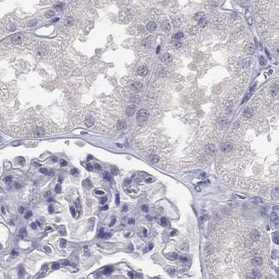 C16orf89 Antibody in Immunohistochemistry (IHC)