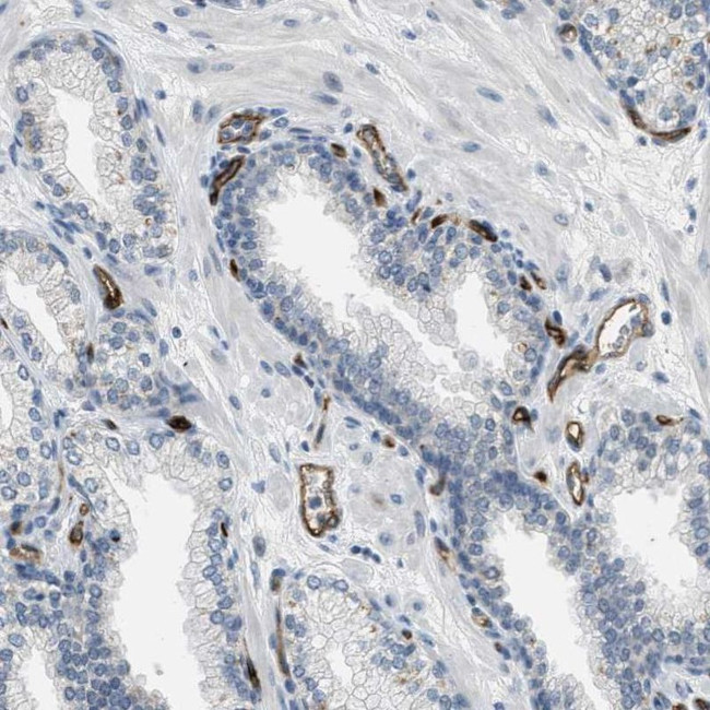 SLCO2A1 Antibody in Immunohistochemistry (IHC)