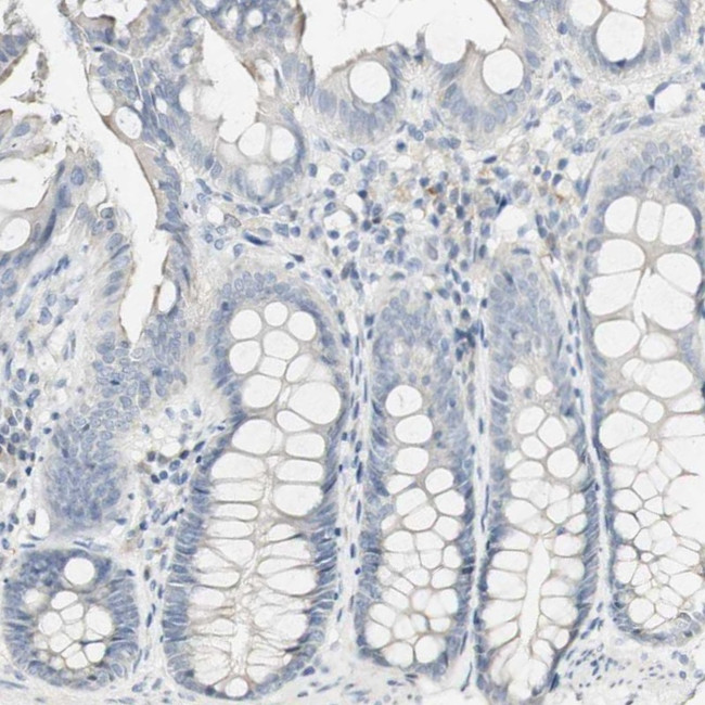 FMO3 Antibody in Immunohistochemistry (IHC)