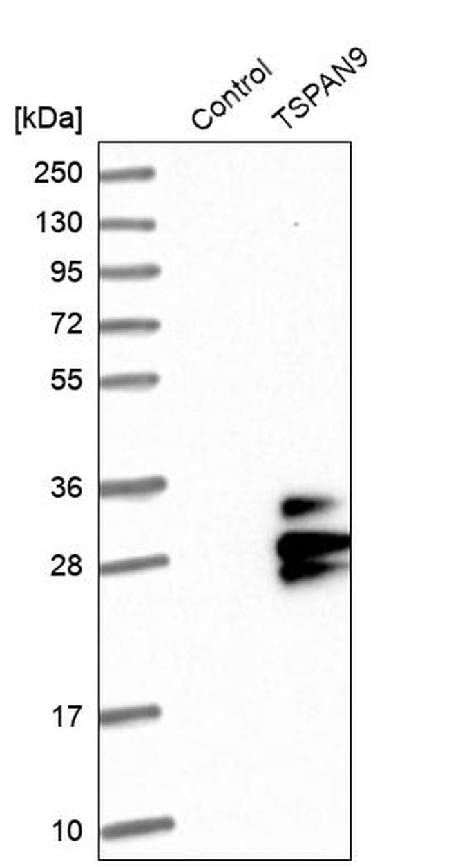 TSPAN9 Antibody in Western Blot (WB)