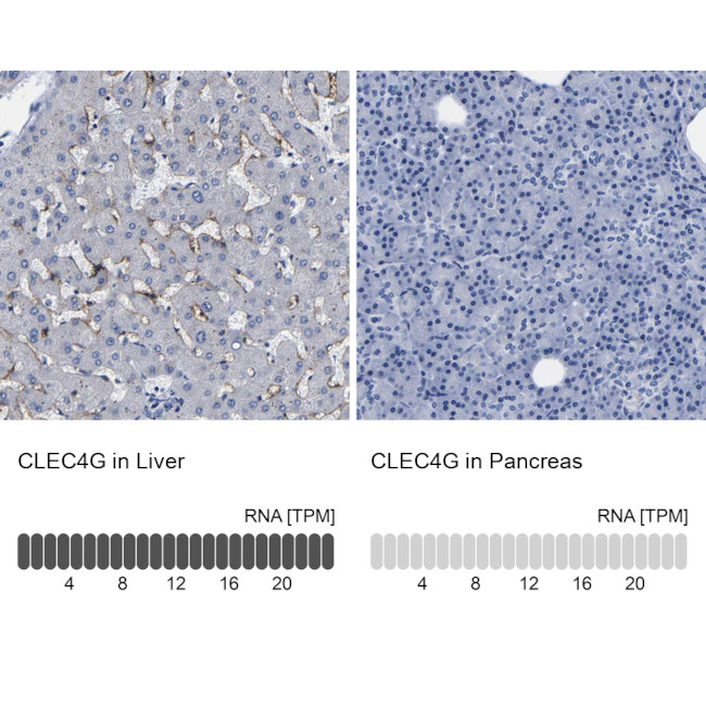 CLEC4G Antibody in Immunohistochemistry (IHC)