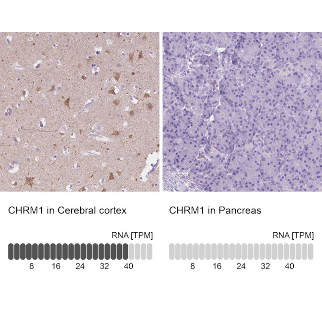 CHRM1 Antibody in Immunohistochemistry (IHC)