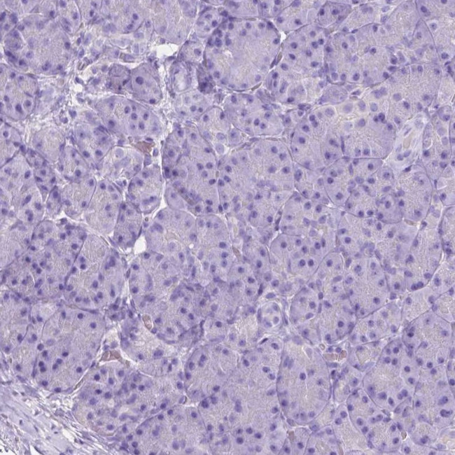 CHRM1 Antibody in Immunohistochemistry (IHC)