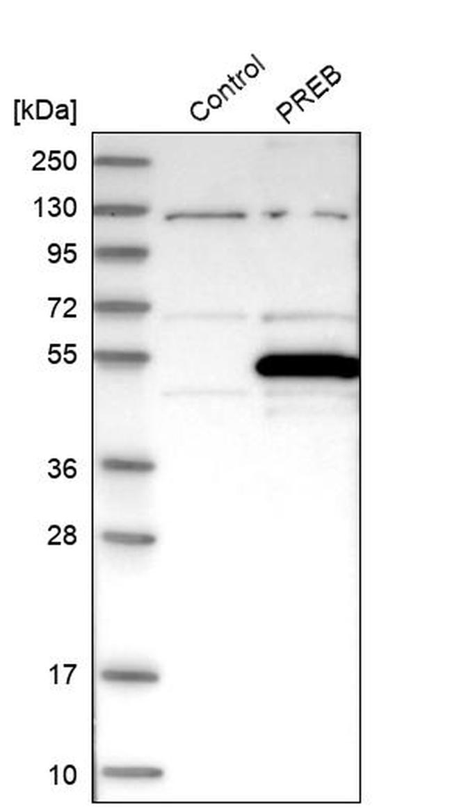 PREB Antibody in Western Blot (WB)