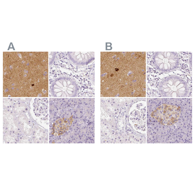 NECAB2 Antibody in Immunohistochemistry (IHC)