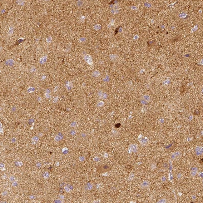 NECAB2 Antibody in Immunohistochemistry (IHC)