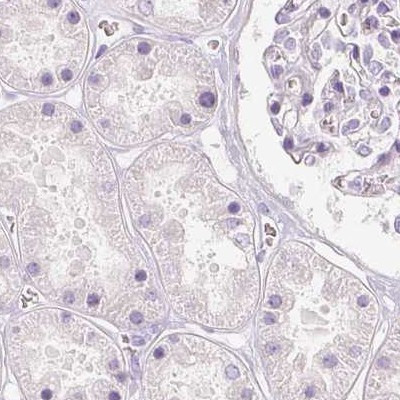 NECAB2 Antibody in Immunohistochemistry (IHC)