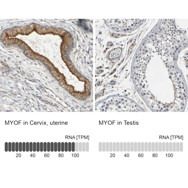 MYOF Antibody