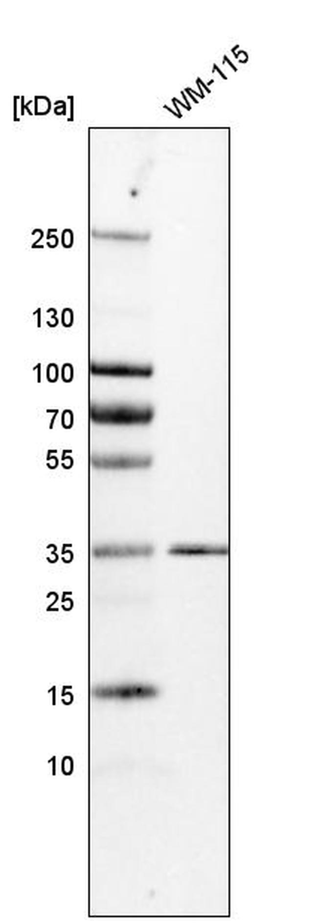 KCTD10 Antibody in Western Blot (WB)