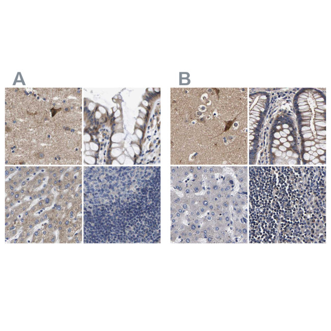 Axotrophin Antibody in Immunohistochemistry (IHC)