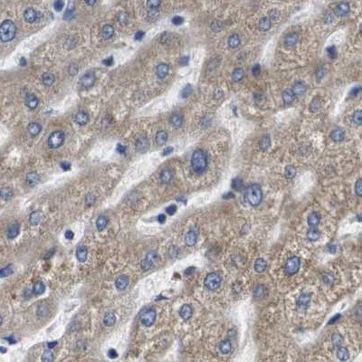 Axotrophin Antibody in Immunohistochemistry (IHC)