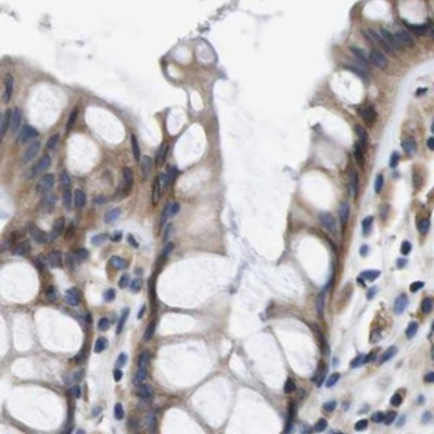 Axotrophin Antibody in Immunohistochemistry (IHC)