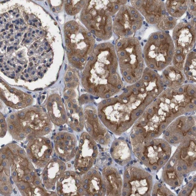 ARHGAP24 Antibody in Immunohistochemistry (IHC)