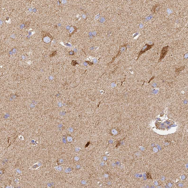 COX6C Antibody in Immunohistochemistry (IHC)