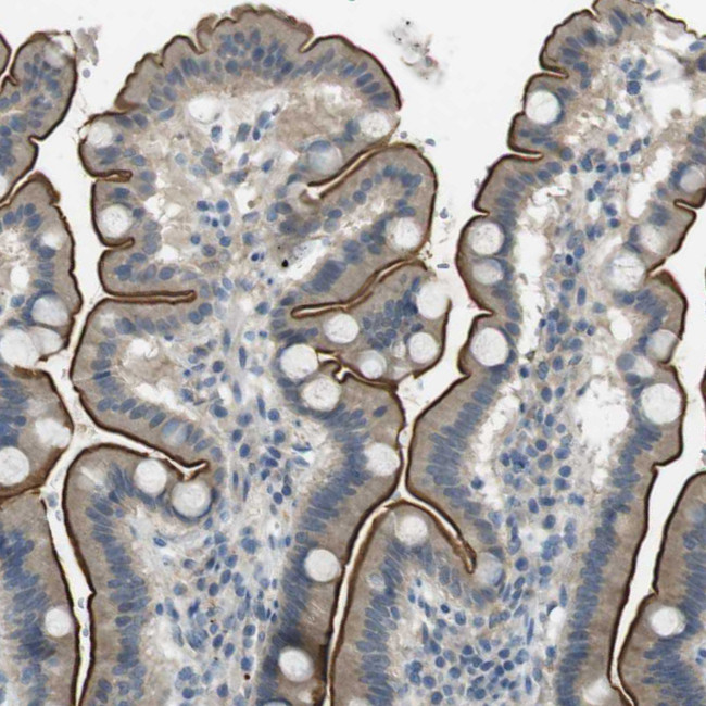 UGT8 Antibody in Immunohistochemistry (IHC)