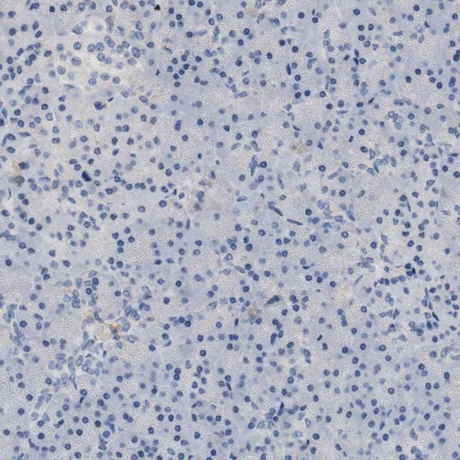 PRRT2 Antibody in Immunohistochemistry (IHC)