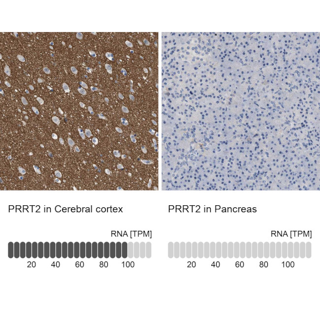 PRRT2 Antibody