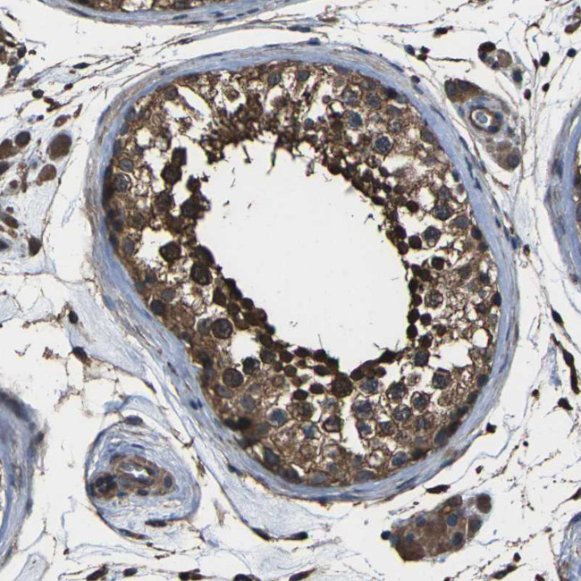 DHPS Antibody in Immunohistochemistry (IHC)