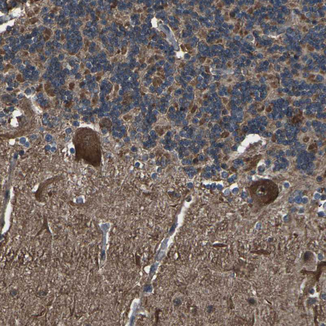 DHPS Antibody in Immunohistochemistry (IHC)