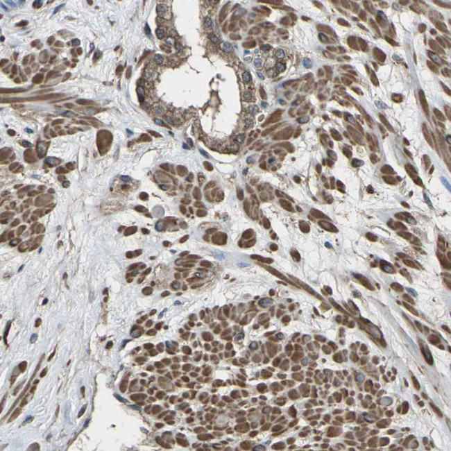 DHPS Antibody in Immunohistochemistry (IHC)