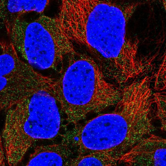 CLCN2 Antibody in Immunocytochemistry (ICC/IF)