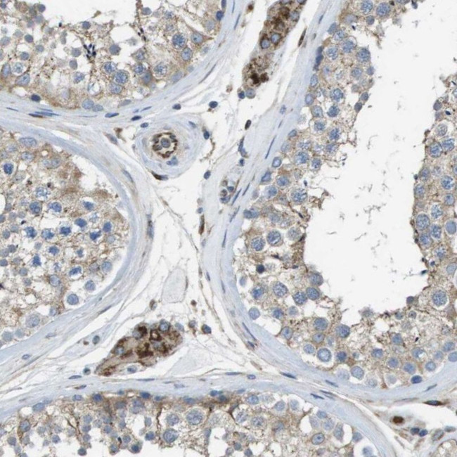 CLCN2 Antibody in Immunohistochemistry (IHC)