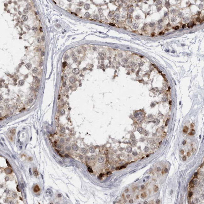 SLC25A22 Antibody in Immunohistochemistry (IHC)