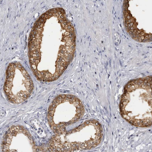 SLC25A22 Antibody in Immunohistochemistry (IHC)