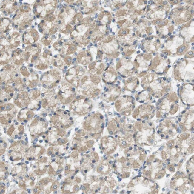 ZDHHC20 Antibody in Immunohistochemistry (IHC)