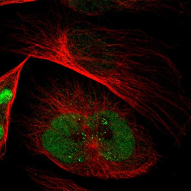 EMP2 Antibody in Immunocytochemistry (ICC/IF)