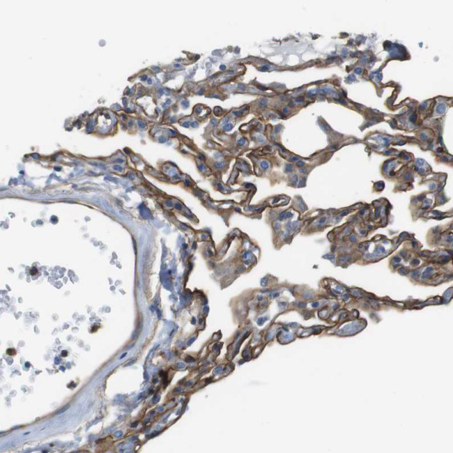 EMP2 Antibody in Immunohistochemistry (IHC)