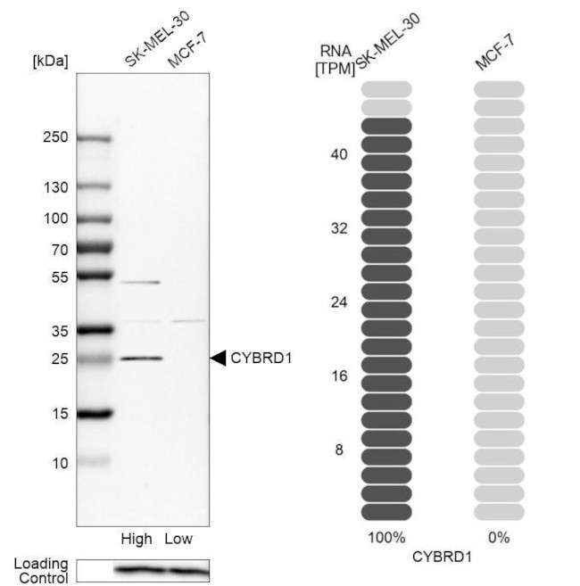 CYBRD1 Antibody