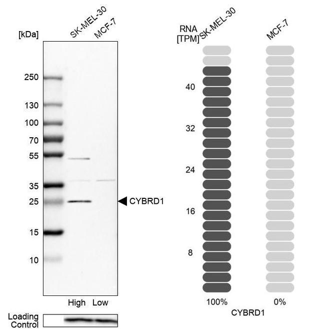 CYBRD1 Antibody in Western Blot (WB)