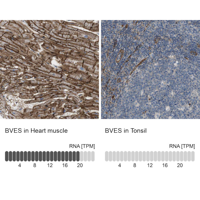 BVES Antibody in Immunohistochemistry (IHC)