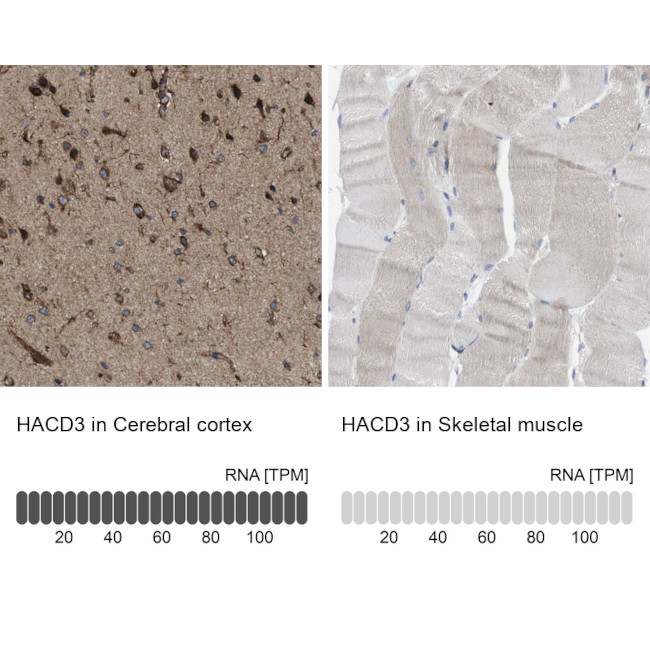 PTPLAD1 Antibody in Immunohistochemistry (IHC)