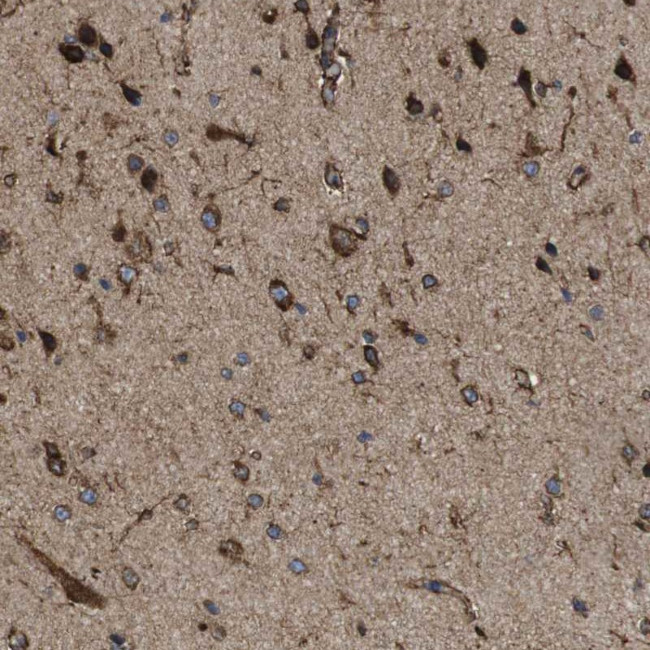 PTPLAD1 Antibody in Immunohistochemistry (IHC)