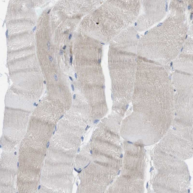 PTPLAD1 Antibody in Immunohistochemistry (IHC)