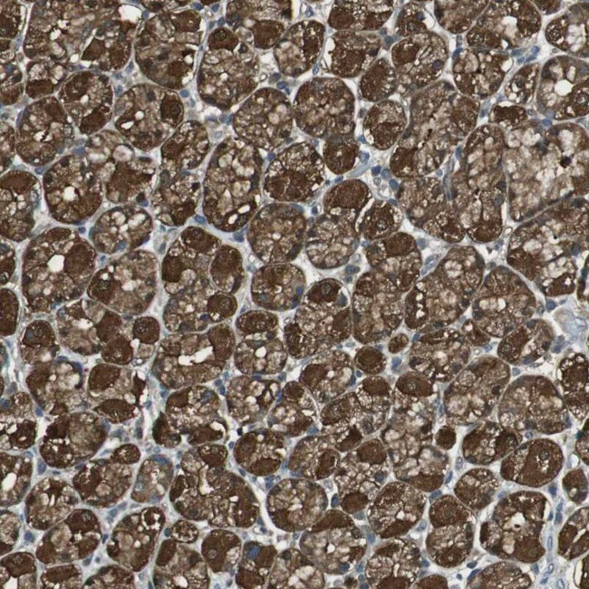 TSG Antibody in Immunohistochemistry (IHC)