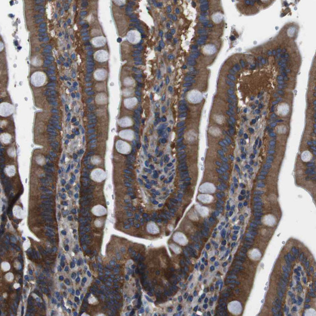 DENND4C Antibody in Immunohistochemistry (IHC)