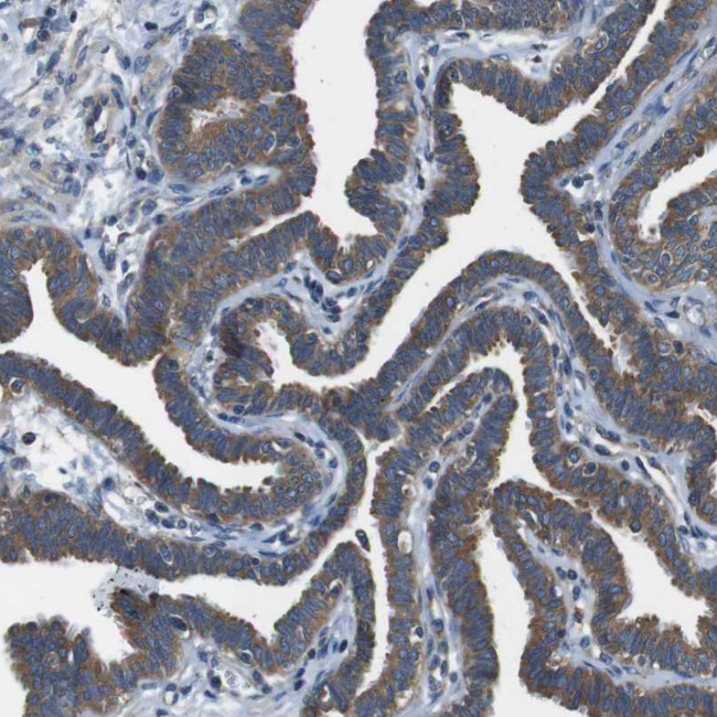 DENND4C Antibody in Immunohistochemistry (IHC)