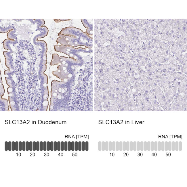 SLC13A2 Antibody in Immunohistochemistry (IHC)