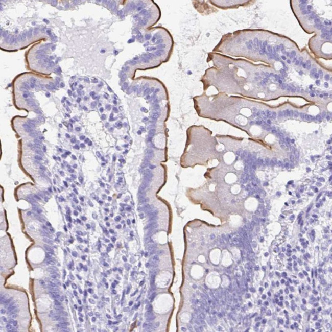 SLC13A2 Antibody in Immunohistochemistry (IHC)