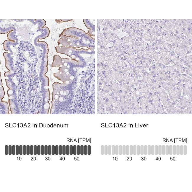 SLC13A2 Antibody