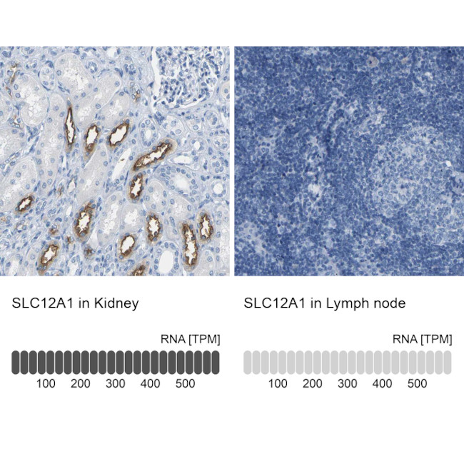 NKCC2 Antibody in Immunohistochemistry (IHC)