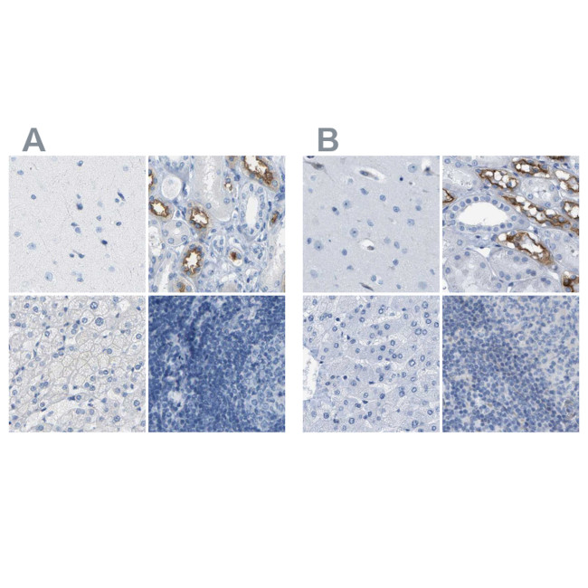 NKCC2 Antibody in Immunohistochemistry (IHC)