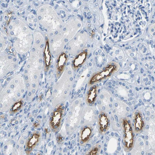 NKCC2 Antibody in Immunohistochemistry (IHC)