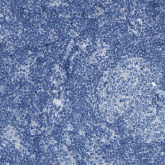 NKCC2 Antibody in Immunohistochemistry (IHC)