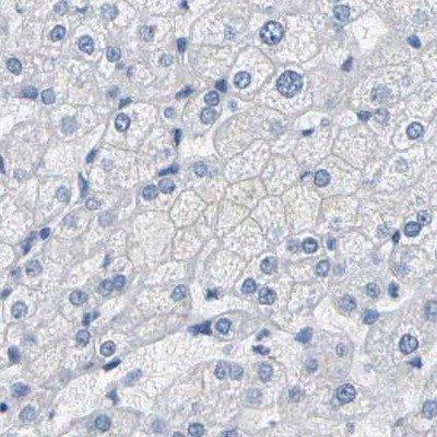 NKCC2 Antibody in Immunohistochemistry (IHC)