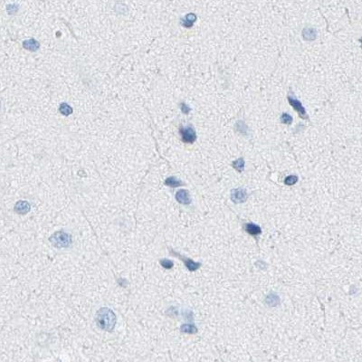 NKCC2 Antibody in Immunohistochemistry (IHC)