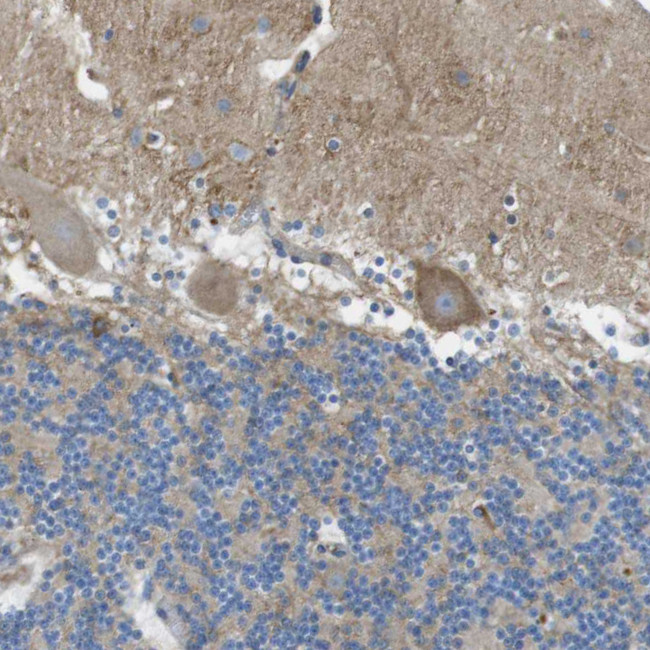 PTPRZ Antibody in Immunohistochemistry (IHC)